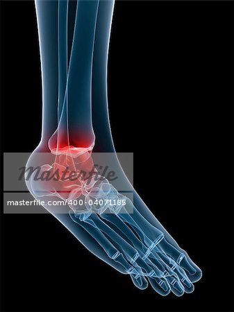 3d rendered illustration of a human skeletal foot with painful ankle