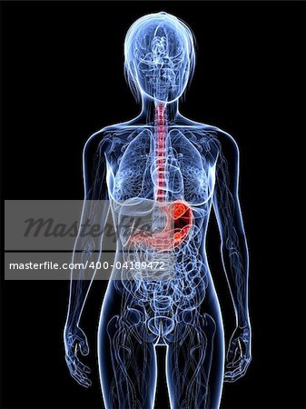 3d rendered illustration of a transparent female body with tumor in stomach