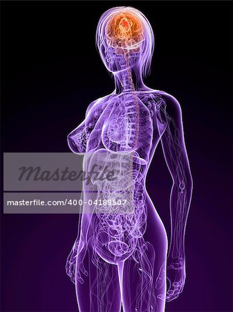 3d rendered illustration of a transparent female anatomy with tumor in brain
