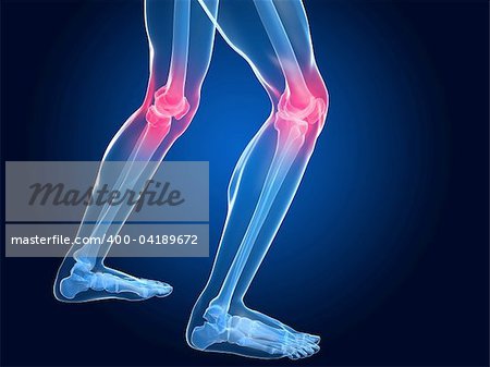 3d rendered illustration of skeletal knees with painful joints