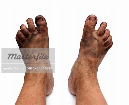 dirty unhygienic feet isolated on white