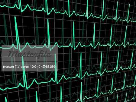 ECG tracing monitor. EPS 8 vector file included