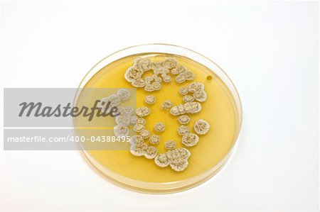 plate with fungi in laboratory of microbiology