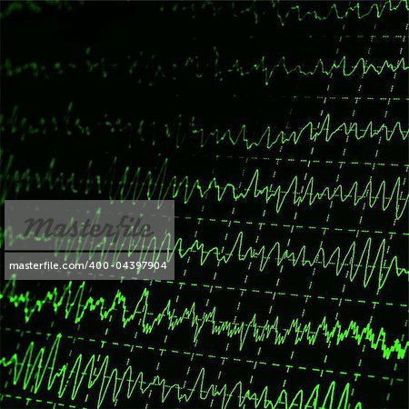 green graph brain wave EEG