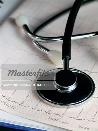 Stethoscope laying on the cardiogram