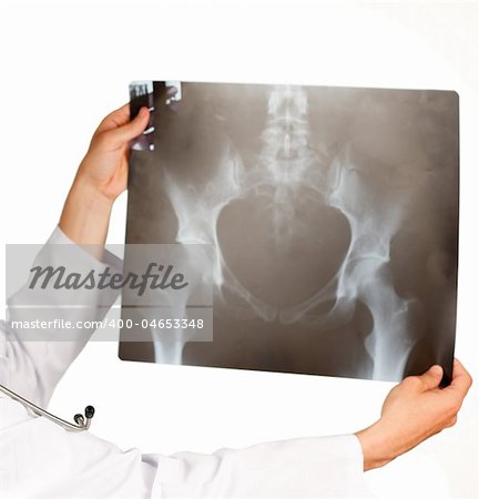 Clouse-up of an X-ray hold by a doctor