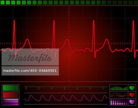 heart monitor screen with normal beat signal