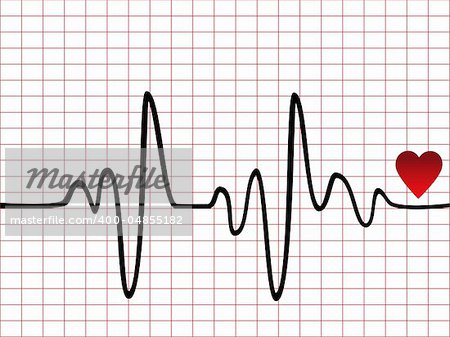 Heart beat monitor or EKG