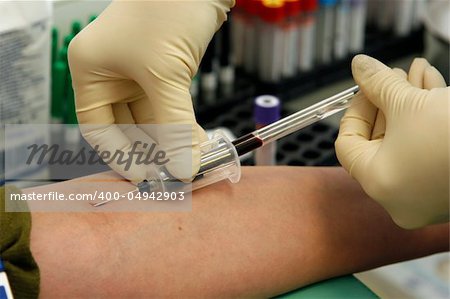 Procedure of a  blood capture from a vein for carrying out of laboratory analyses