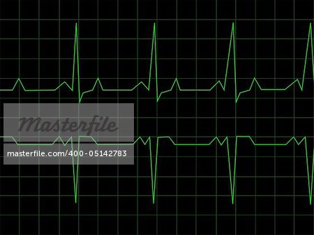 Normal Heart Rhythm electrocardiogram ECG graph with black background