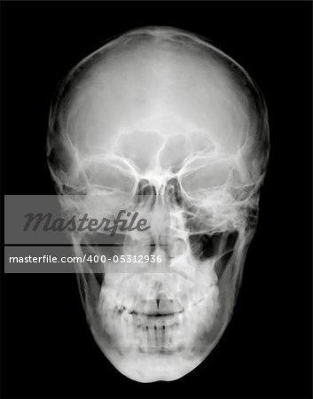 Front view of human head on black and white x-ray film