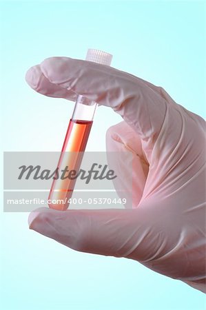 Hand holding a blood sample for analysis