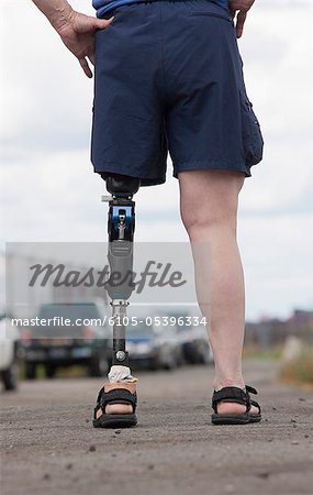 Woman with prosthetic leg standing on the road