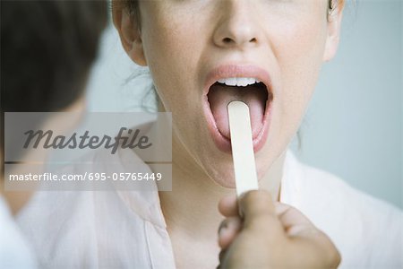 Doctor holding down woman's tongue with tongue depressor