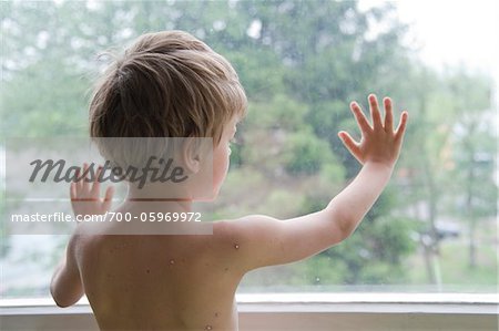 Boy with Chicken Pox Looking Out Window