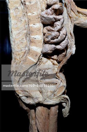 Plastinés homme mâle Section sagittale de la cavité abdominale, la colonne vertébrale et le bassin