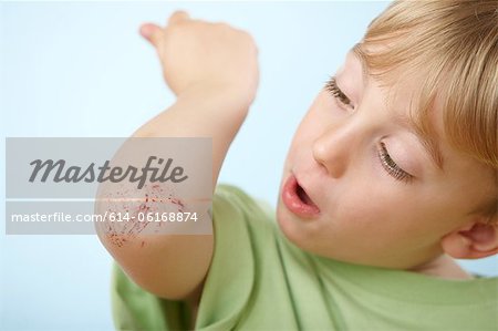 Boy with grazed elbow