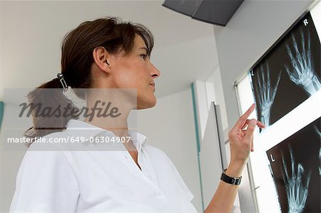 Doctor examining x-rays of hands