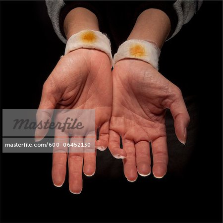 Close-up of Woman's Hands and Stains on Bandaged Wrists, Studio Shot