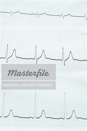 close-up of an electrocardiogram report