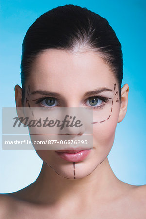 Young woman with presurgical markings on face