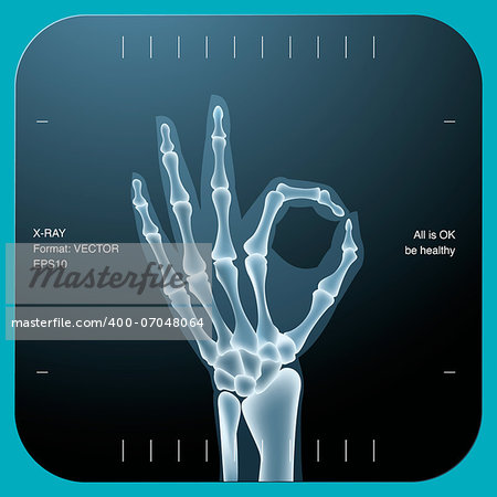 X-ray of both human hand (OK!), vector Eps10 illustration.