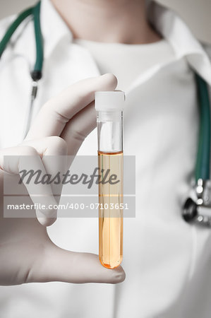 Doctor holding a bottle of urine sample