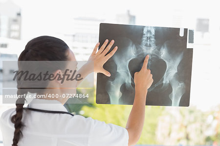 Rear view of a female doctor examining xray in the medical office