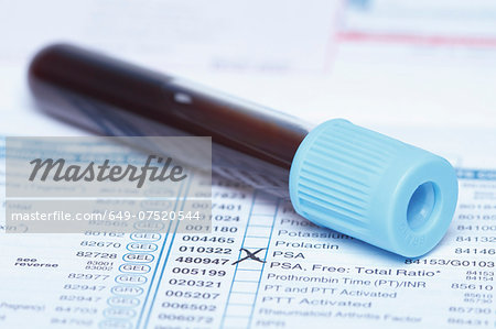 Color coded tube containing synthetic blood sample on a bloodwork requisition form that lists a test for prostate-specific antigen (PSA)