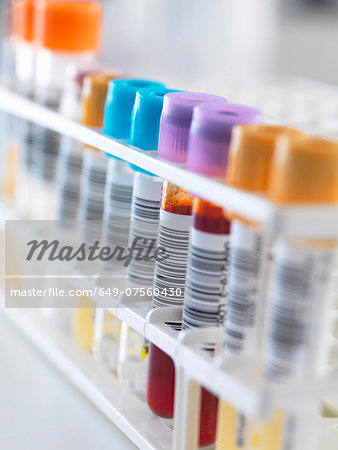 A row of human samples for analytical testing including blood, urine, chemistry, proteins, anticoagulants and HIV A row of human samples for analytical testing including blood, urine, chemistry, proteins, anticoagulants and HIV