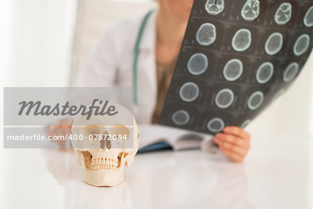 Closeup on human skull and medical doctor woman with fluorography in background