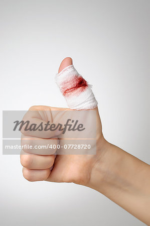Injured finger with bloody gauze bandage