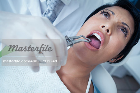 Close up of woman having her teeth examined by dentist