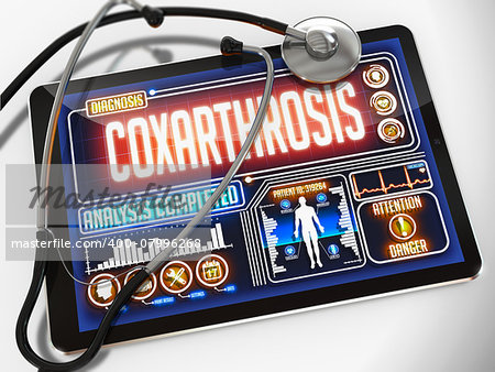 Coxarthrosis - Diagnosis on the Display of Medical Tablet and a Black Stethoscope on White Background.