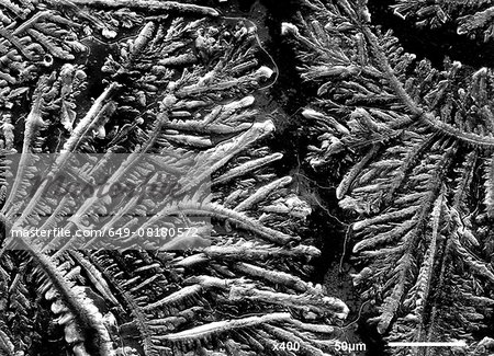 Complexity of human sadness teardrop imaged in a scanning electron microscope