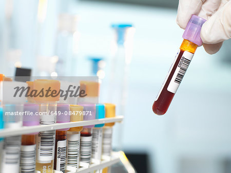 Laboratory technician preparing blood sample for medical testing in laboratory