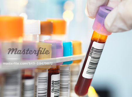 Laboratory technician preparing blood sample for medical testing in laboratory