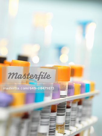 Blood sample for medical testing in laboratory Blood sample for medical testing in laboratory