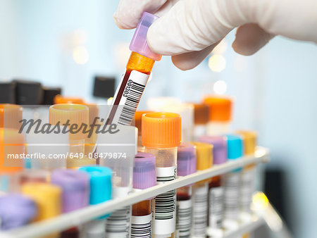 Laboratory technician preparing blood sample for medical testing in laboratory