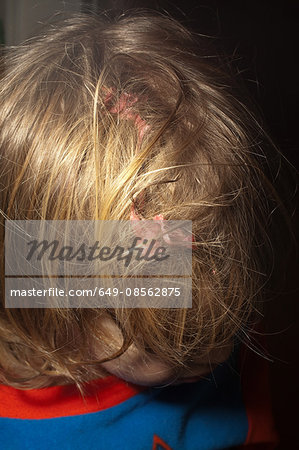 Boy with chewing gum stuck in hair