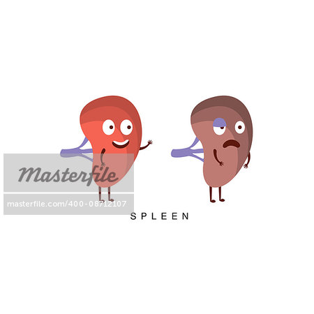 Healthy vs Unhealthy Spleen Infographic Illustration.Humanized Human Organs Childish Cartoon Characters On White Background