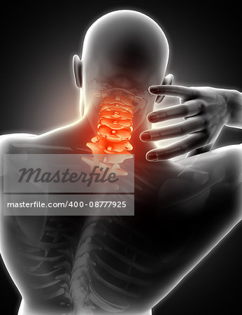 3D render of a medical image showing a male with neck pain