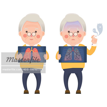 Vector Illustration of Happy Old Man Holding X-ray Image Showing Healthy Lung Compare with Sad Man Showing Lung Pulmonary Emphysema Problem, Cartoon Character