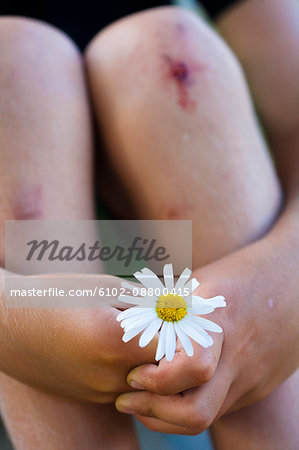 Boy with scrapes on knees holding ox-eye daisy flower