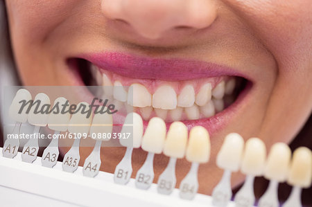 Dentist examining female patient with teeth shades at dental clinic