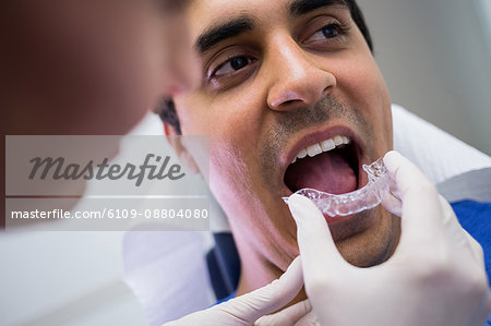 Dentist assisting a patient to wear orthodontic silicone invisible braces