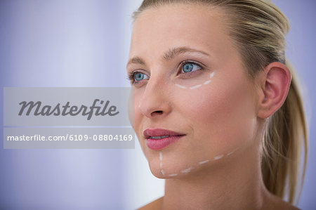 Close-up of woman with marks drawn for cosmetic treatment