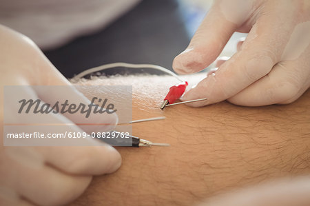 Physiotherapist performing electro dry needling on the knee of a patient