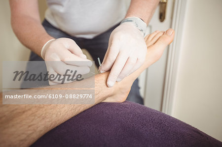 Physiotherapist performing dry needling on the leg of a patient