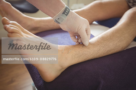 Physiotherapist performing dry needling on the leg of a patient